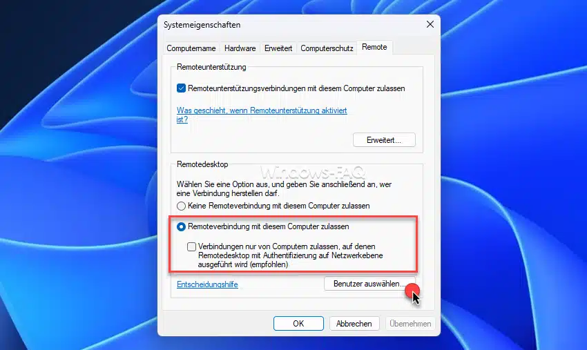 Remotedesktop Verbindung mit diesem Computer zulassen