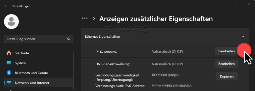 Windows IP-Zuweisung